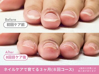 Before/After【feerie立川】