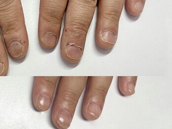 キラネイル アンド アイラッシュ by World Beauty(KIRA)/新潟自爪育成