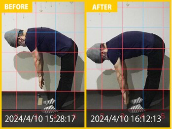 整体院 元 光の森店/頭痛の肩の痛み