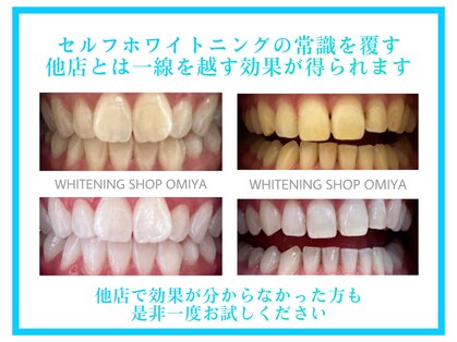ホワイトニングショップ 大宮店の写真
