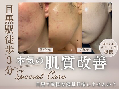 ベルフィーヌ 目黒店(BELFINE)の写真