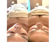 ふわりんの雰囲気（バスト専門店に行かなくてもこの結果がついてくるのでお得！）