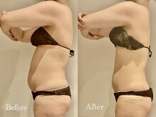 エステティック ミュー(Esthetic MiEUX)の雰囲気（都度払い～お得なコースでご自身のペースで通って頂けます◎）