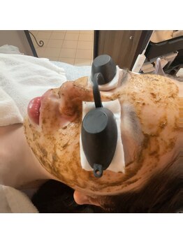 サロントゥエンティーフィフスアベニューニコ(Salon 25th ave.)/☆ハーブピーリング☆