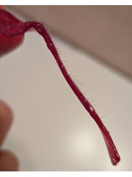 ワックス脱毛サロン アルスタ(ALUSTA)/