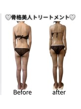 フォルスボーテ(Force Beaute)/【骨格美人トリートメントBA】