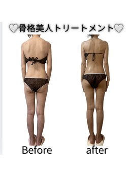 フォルスボーテ(Force Beaute)/【骨格美人トリートメントBA】