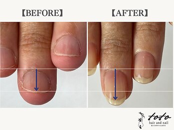 トトヘアー アンド ネイル(toto hair and nail)/【toto式】深爪育成ネイルケア