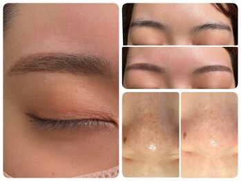 トータルビューティ ノイド(Noid)/小鼻コース+美眉毛WAX脱毛