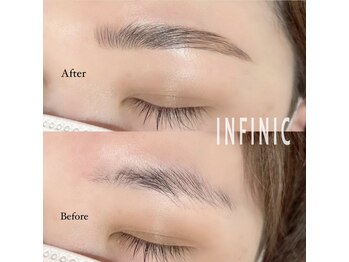 アンフィニック(INFINIC)/ハリウッドブロウリフト