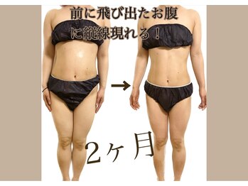 ウェリナポノビューティサロン(welina pono beauty salon)/《痩身/ダイエット/小顔》