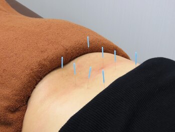 そよな はり灸整骨院/はり