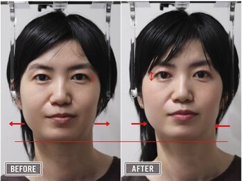 さつま骨格矯正 表参道青山院/歪み小顔矯正＋骨盤矯正