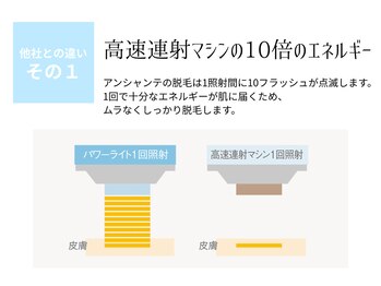 ピュアノア 三木店/脱毛　三木/小野/西脇/加東/加西