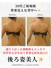 エーシーサロン 六本木店(acsalon)/脱！背中おばさん化で華奢見え♪