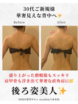 エーシーサロン 六本木店(acsalon)/脱!背中おばさん化で華奢見え♪