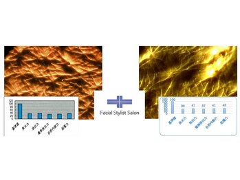 フェイシャルスタイリストサロン 高崎店(Facial Stylist Salon)/キメのケア例(1)