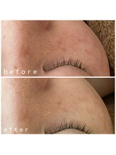 メナードフェイシャルサロン 岐阜茜部/エイジング、贅沢ケア