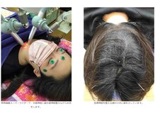 よしだ鍼灸整骨院 整体院/自律神経にアプローチしている所