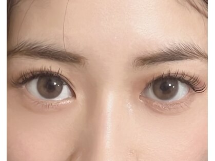 ヨウコ(yoko)の写真