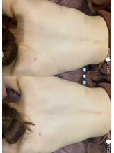 フルール(Fleur)/■背中トリートメント■