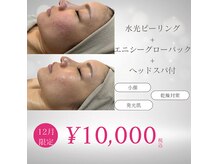 リノ レイ(Lino Ray)