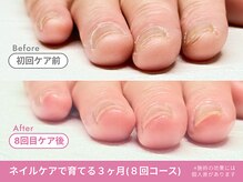 フェリエ(feerie)/Before/After【feerie立川】