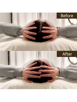 小顔矯正&美容整体サロン Still U 渋谷/ヘッドスパ+小顔矯正