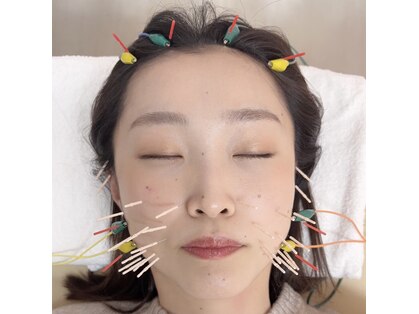木下美容鍼灸整骨院の写真
