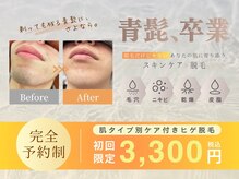 髭ラボ(髭LABO)
