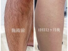 スパロウ(RF sparrow)/４１歳　男性