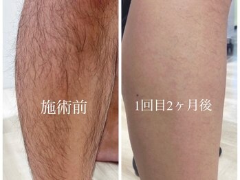 スパロウ(RF sparrow)/41歳 男性