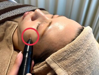 サロン アグランシュ(salon A.glansh)/低周波シミケアで美肌に☆