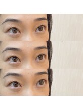 シアミス(SIAMIHS)/まつげパーマ