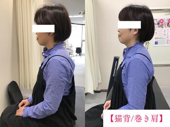 ボディメイク アールエフ サクラ接骨院(bodymake RF SAKURA接骨院)/猫背/巻き肩矯正
