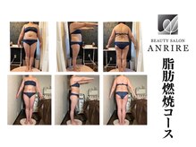 アンリール 苫小牧店(ANRIRE)の雰囲気(脂肪燃焼コースの一例になります)