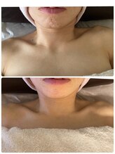 トリートメントルーム フェリーチェ(Felice)/美肌と小顔の土台はカラダから