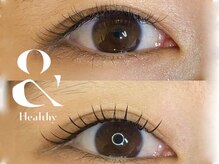 フィールラッシュ バイ グリーン(FEELLASH by green)/＆healthy×LED120本