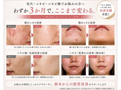 アイデアル(AiDEAL)の写真