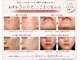 アイデアル(AiDEAL)の写真