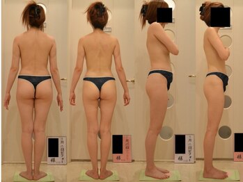 ドクターヴィー 高知(DrVi)/痩せ型の方はさらに引き締めを