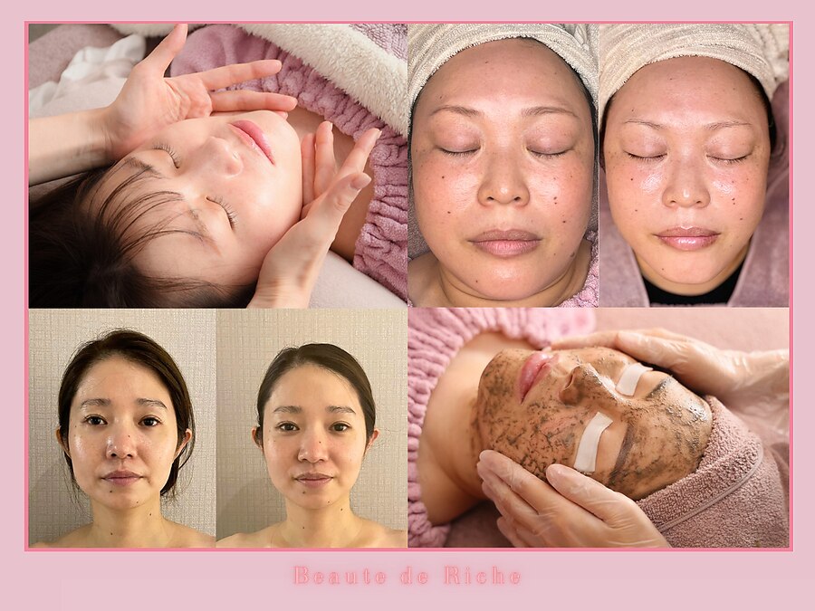 ボーテドリッシュ(Beaute de Riche)の予約ページ掲載写真