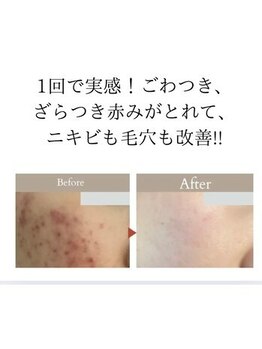 ラグラン銀座メディカルエステ 高輪ゲートウェイ店/医療発想の施術”超ツヤ肌痩身”