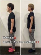 ナナ 吉祥寺店(NANA)/ビフォーアフター