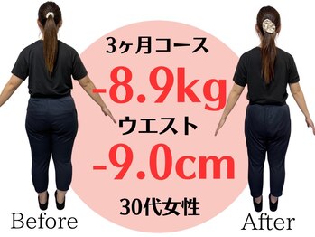 アシストユー整体院/骨盤の開きと太ももがスッキリ！