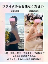 ヨサパーク クラミツハ(YOSA PARK)/痩身