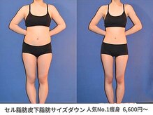 ピュアノア 垂水店/痩身ダイエット　神戸垂水明石