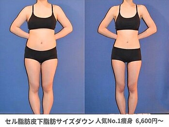 ピュアノア 垂水店/痩身ダイエット 神戸垂水明石