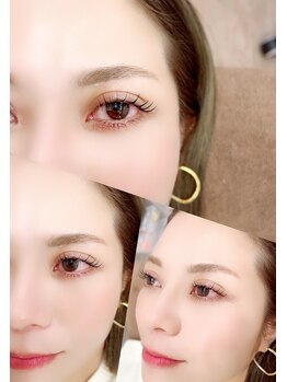 ムーラン(mulan)/メーテルロッド5