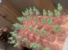 骨気(コルギ)専門店 YONG miu【ヨング ミュー】/カッピング【首肩こり】